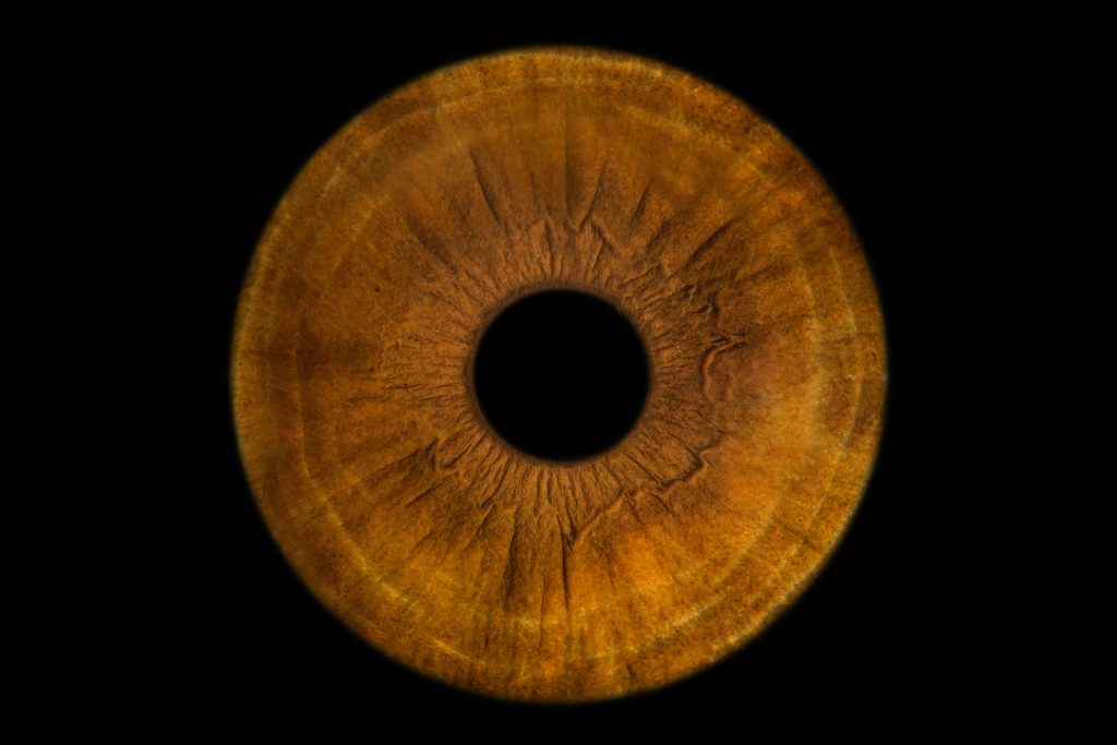 Irisfotografie, braunes Auge